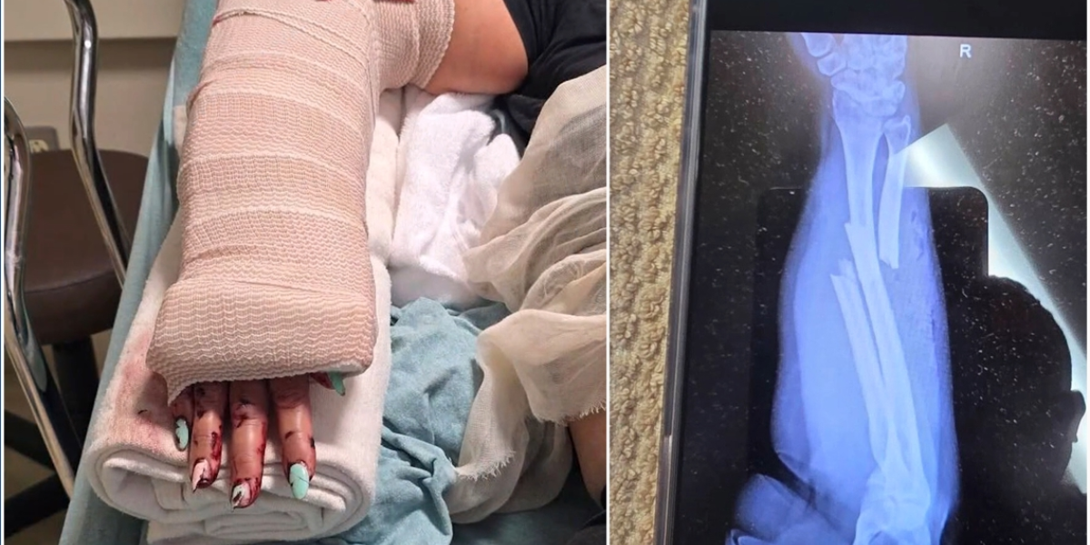 Nanny Shields Toddler From Stranger’s Bat Attack — What She Did Next Will Give You Chills
